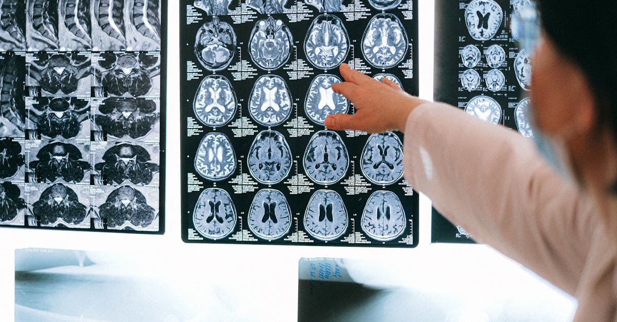 découvrez les fascinantes avancées de la neuroscience, une discipline qui explore le fonctionnement du cerveau humain, ses structures et ses processus complexes. plongez dans les recherches révolutionnaires qui façonnent notre compréhension des émotions, des comportements et des mécanismes cognitifs.